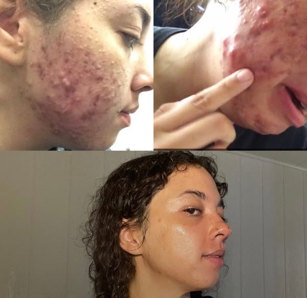 Case Result 1